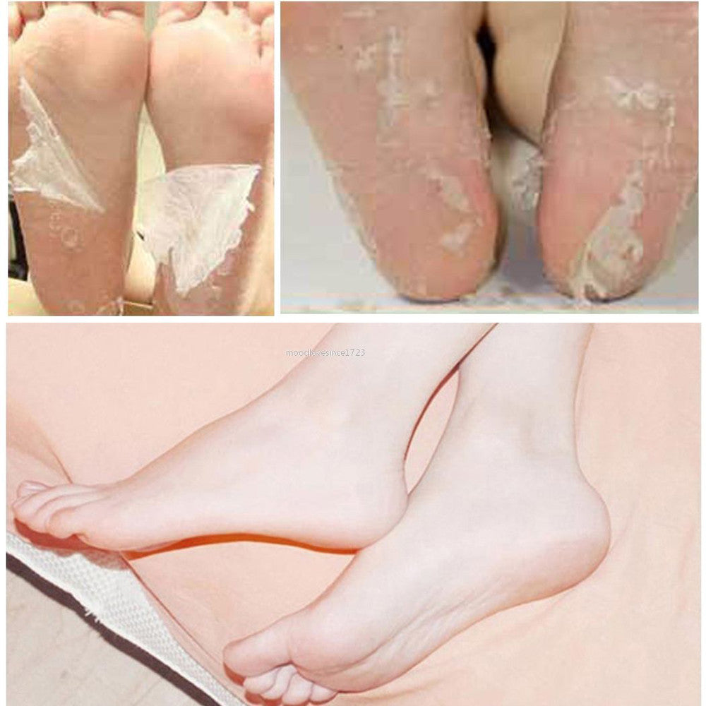 Hot Remove Dead Skin Foot Mask Peeling Cuticles Heel Feet Care Anti Aging